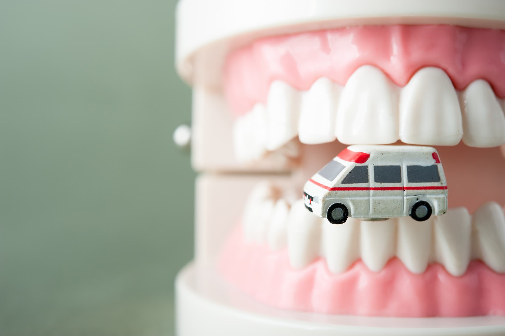 A toy ambulance rests on a tooth, symbolizing emergency dental care in Flagstaff, AZ