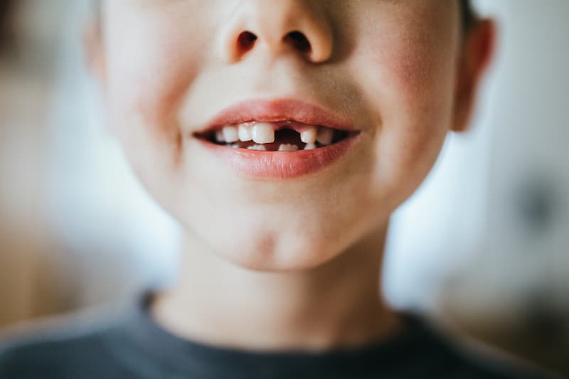 Featured image for “What to Do If You’re Missing a Front Tooth”