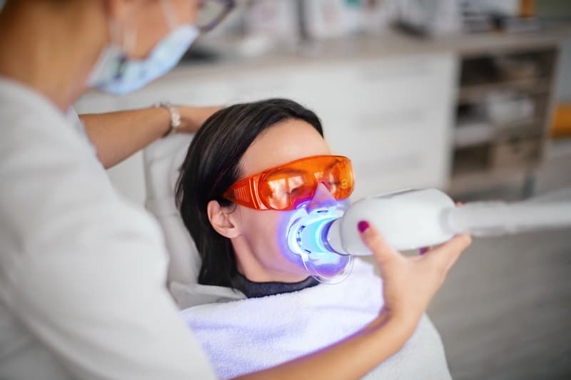 Featured image for “Professional Tooth Whitening: What to Know”
