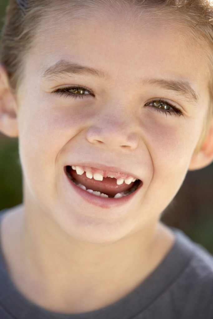 The small kid smiling with broken teeth at Flagstaff, AZ